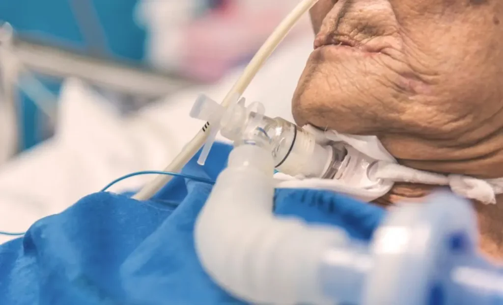 Tracheostomy care at home in Delhi